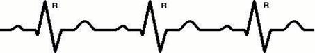 ECG